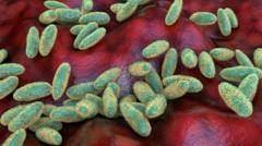 Worker Dies of Pneumonic Plague at Russian Research Lab, Raising Biosecurity Questions