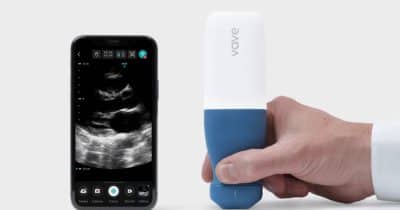 Midjourney Unveils First Hardware Product: An Ultrasonic Scanner